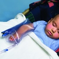 PediatricUrias Air Splints Child Arm Single 12 (30Cm) Each